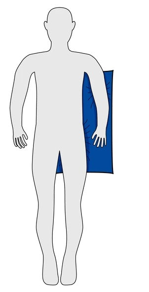 COUSSIN HERDEGEN DE POSITIONNEMENT MICRO-BILLES ANTI ESCARE